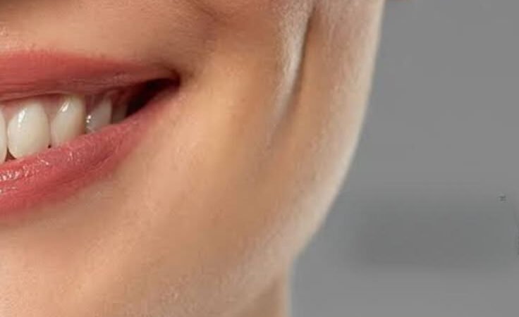 Dimple Creation treatment