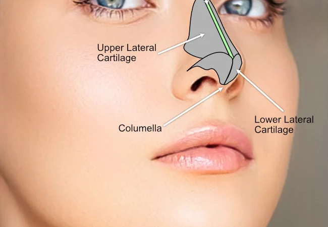 Septoplasty Islamabad pakistan