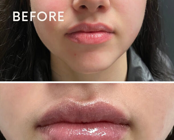 You Aesthetics – Medical Spa
