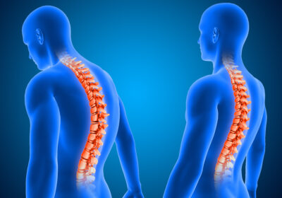 3d-render-showing-correct-poor-posture-with-spine-highlighted
