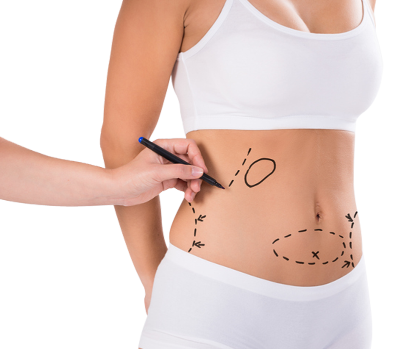 Non-Surgical Liposuction Explained: The Future of Fat Removal in Hyderabad