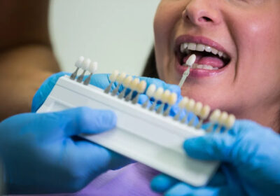 Transform-Your-Smile-with-Dental-Veneers-Plus-Dental-Clinic