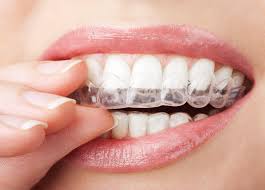invisalign-provider-Century-City