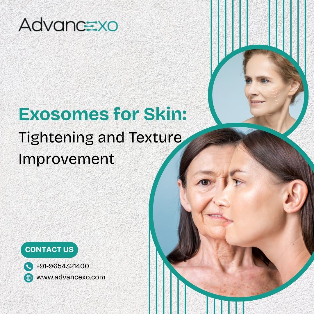 Exosomes for Skin Tightening and Texture Improvement