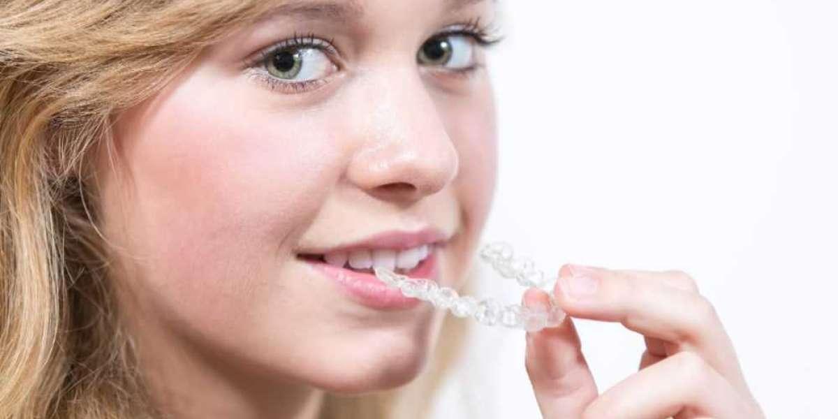 Comparing Teeth Braces Metal, Ceramic