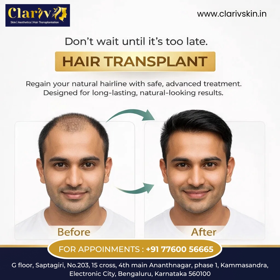 Trusted Hair Transplant Clinic in HSR Layout for Natural Hair Restoration | Clarivskin.in