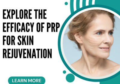 PRP-for-Skin-Rejuvenation