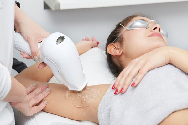 Pre-Wedding Beauty Checklist: Is Laser Hair Removal Worth It?