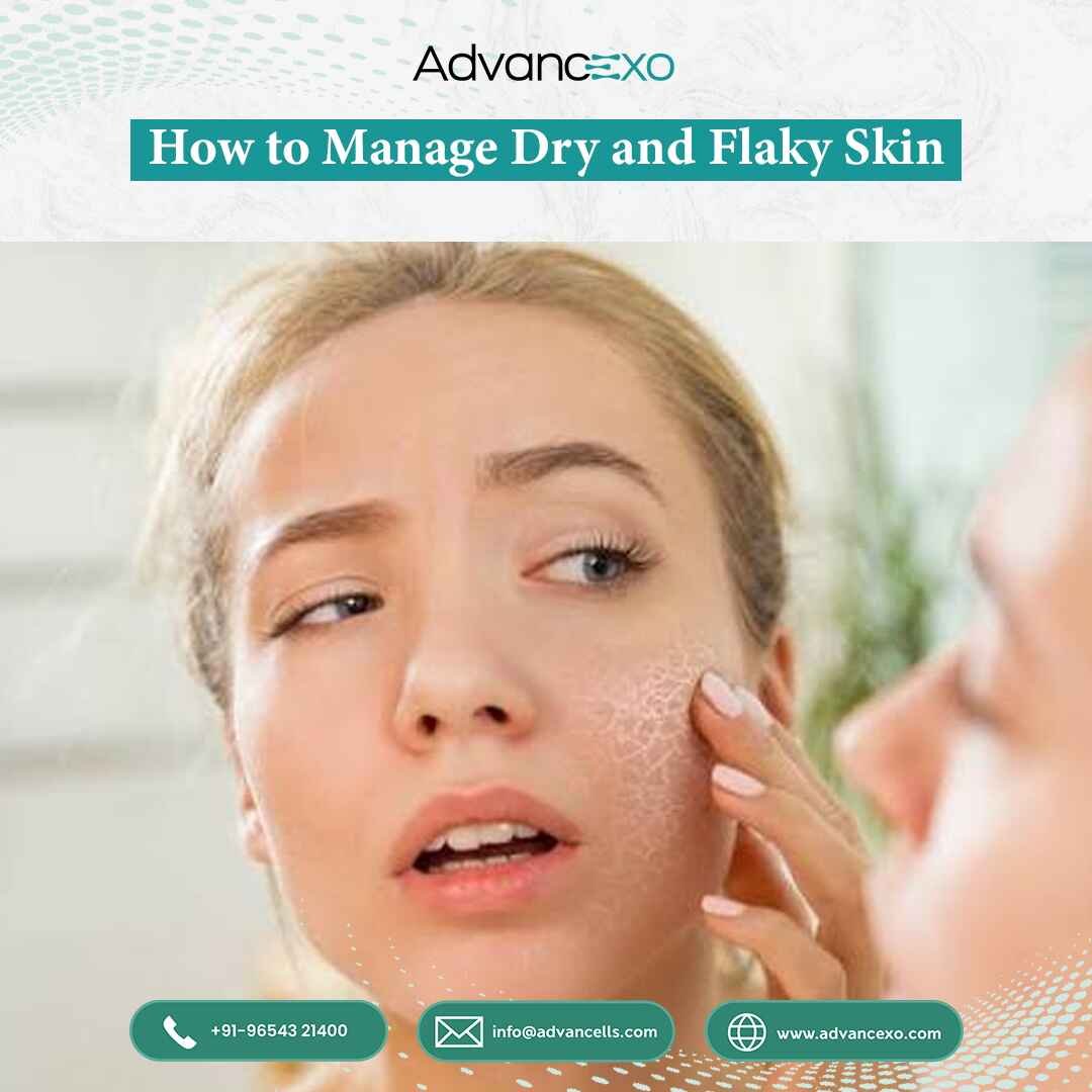 How to Manage Dry and Flaky Skin