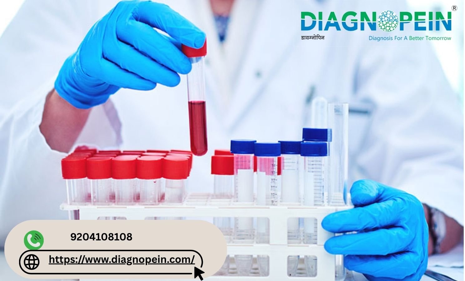 Home Blood Collection Centre Near Me: Convenient Lab Tests at Home
